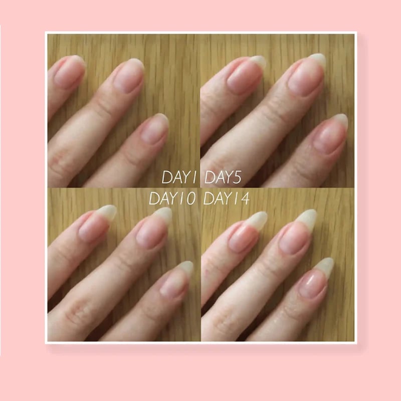🔥2023 Hot Sale🔥NAIL REPAIR PROTECTION GEL