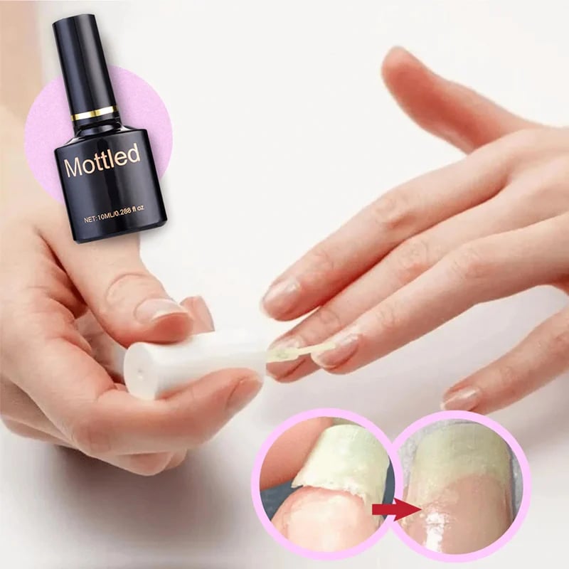 🔥2023 Hot Sale🔥NAIL REPAIR PROTECTION GEL