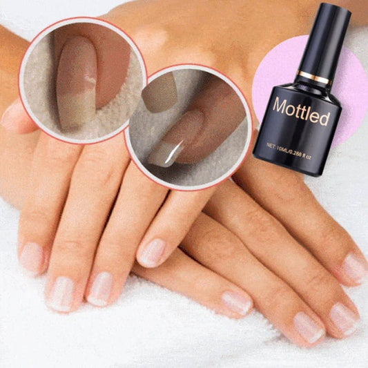🔥2023 Hot Sale🔥NAIL REPAIR PROTECTION GEL