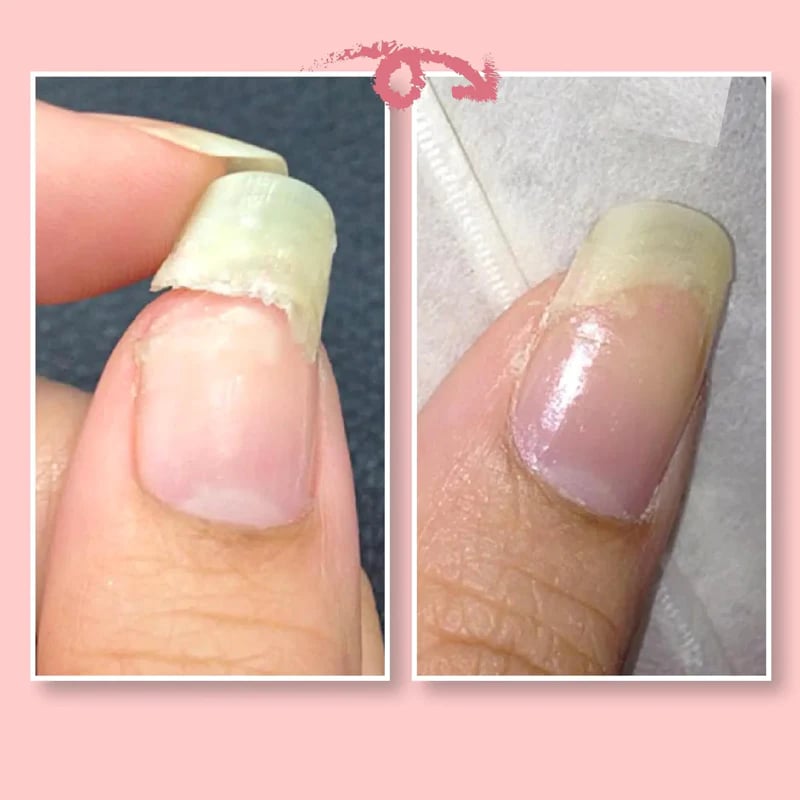 🔥2023 Hot Sale🔥NAIL REPAIR PROTECTION GEL